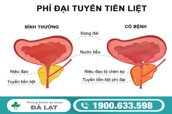 Hình ảnh minh họa